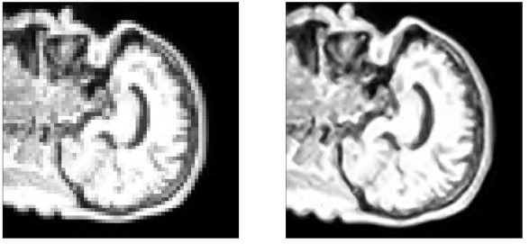 MRI image